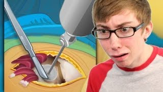 HIP SURGERY iPhone Gameplay Video [upl. by Gwendolin]