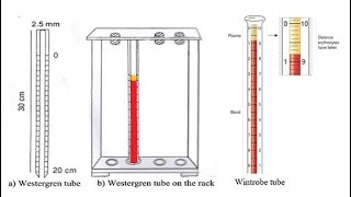 Erythrocyte Sedimentation RateESR Westergren method Vs Wintrobe’s method joenacademy [upl. by Ninnette276]