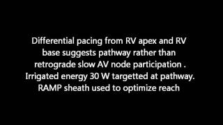 PJRT  Permanent Junctional Reciprocating Tachycardia [upl. by Nathalia559]