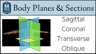 EASY TRICKS for Anatomical Body Planes and Sections DirectionPosition [upl. by Juanita]