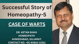 HOMEOPATHY SUCCESS STORIES5  A CASE OF WARTS  DR KETAN SHAH  HINDI [upl. by Nyltiac779]