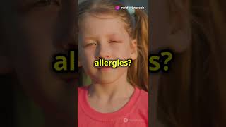 What are Allergies [upl. by Orlene]