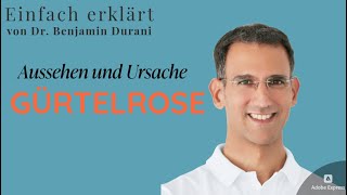 Gürtelrose  Aussehen und Ursachen  Einfach erklärt von Dr Durani Facharzt für Hautkrankheiten [upl. by Leonidas]