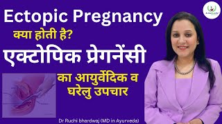 Ectopic Pregnancy क्या होती है । Ectopic Pregnancy का आयुर्वेदिक इलाज । एक्टोपिक प्रेगनेंसी लक्ष्ण [upl. by Molli739]