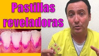 Pastillas reveladoras de placa dentobacteriana ¿Qué son y para qué sirven [upl. by Mcgregor]