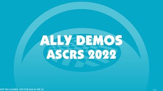 LENSAR ASCRS 2022  ALLY™ System Demos [upl. by Htebasile]