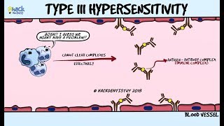 Type III Hypersensitivity  Immune complex disease [upl. by Apfelstadt]