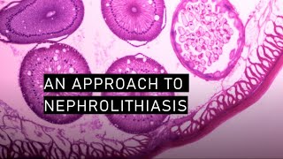 An approach to nephrolithiasis [upl. by Eelitan407]