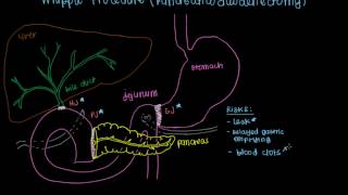 Whipple Procedure Pancreaticoduodenectomy [upl. by Suiddaht]