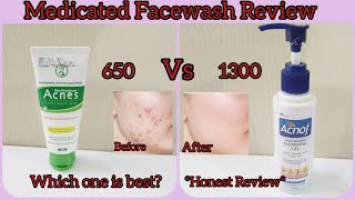 Best Medicated Acne Facewash In Pakistan Honest Review facewashforacneproneskin [upl. by Homerus707]