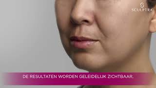 FINAL Sculptra wachtkamer video NL 2 [upl. by Adnohser]