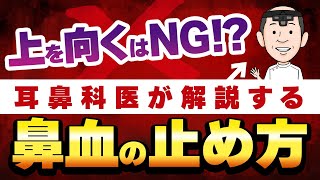 【鼻血を繰り返す方へ】最も効果的な鼻血の止め方・NG行動を鼻血が止まらない原因から耳鼻科医が徹底解説 [upl. by Elay]