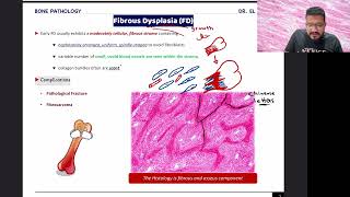 Fibrous Dysplasia  Paget Disease  Brown Tumor Osteitis Fibrosa Cystica [upl. by Madra]