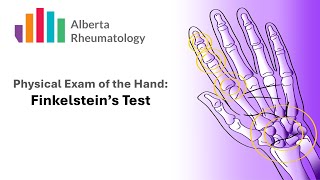 Rheumatology HAND exam Finkelsteins Test for DeQuervains Tenosynovitis [upl. by Slaughter]