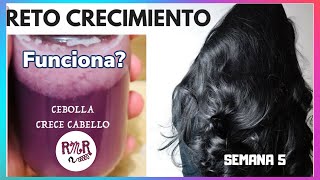 CEBOLLA PARA EL CABELLO  COMO FORTALECER Y HACER CRECER EL CABELLO con jugo de cebolla [upl. by Akirdnwahs744]