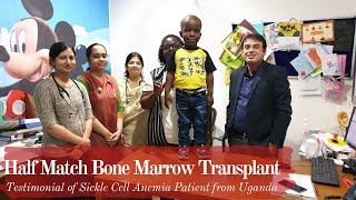 Half match Bone Marrow Transplant  Haploidentical  Sickle Cell Anemia Patient from Uganda [upl. by Epuladaugairam538]