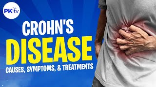 Crohns disease the causes symptoms and treatment  Poop Knowledge TV [upl. by Aihsenad416]