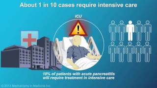 Management and Treatment of Acute Pancreatitis [upl. by Brina]