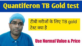 Quantiferon TB Gold test in Hindi  टीबी मरीजों के लिए TB gold टेस्ट क्या है  Result amp Normal value [upl. by Siduhey911]