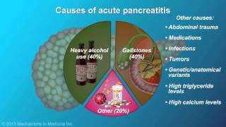 Acute Pancreatitis [upl. by Allerus]