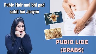 Pubic Lice CRABS  नीचे के बालों में भी पड़ सकती हैं जुएं  bebold  Tanushi and family [upl. by Eladnor]