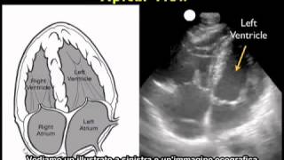 Video procedurale Ecografia cardiaca  Vista apicale [upl. by Ilehs]