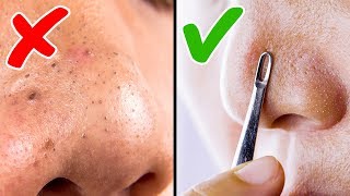 4 Maneras Eficientes De Remover Y Evitar Puntos Negros [upl. by Ivonne]