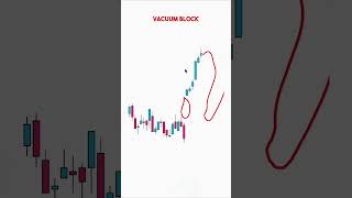 Vacuum Block Explained [upl. by Raquela]