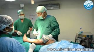 Varicose veins Kerala  Dr Roy Varghese [upl. by Maice]