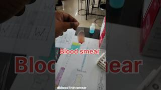 Blood Smear preparationlabtechnician bscnursing smear [upl. by Ytte608]