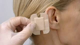 Mepilex Border Flex Lite  Application on ear [upl. by Alyam]