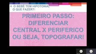 Síndrome do bebê Hipotônico –Dia 26 de novembro de 2020 [upl. by Etteneg868]