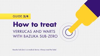 How to treat verrucas and warts with Bazuka SubZero [upl. by Card]