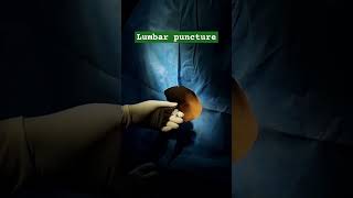 Lumbar puncture lumbarpuncture lumbarpunctureprocedure TechhealthOT [upl. by Nnaecarg]