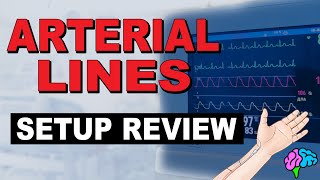 The Arterial Line Setup REVIEWED [upl. by Nallid817]