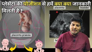 placenta posterior means boy or girl  anterior placenta baby gender  ultrasound se jane ladka [upl. by Latin119]