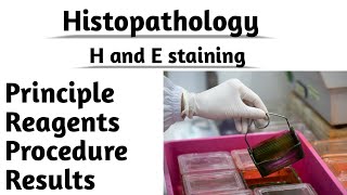 Histopathology H and E staining Principle reagents Procedure Results Tissue staining [upl. by Nitnelav]