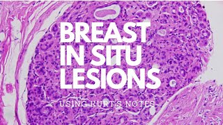 Breast In Situ Lesions Kurt’s Notes pathagonia [upl. by Loginov]