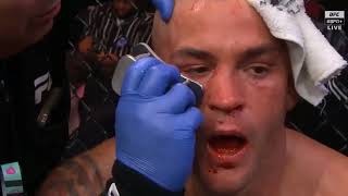 Islam Makhachev Vs Dustin Poirier Full Fight Highlights  Makhachev Submits Poirier  UFC 302 [upl. by Nylahsoj]