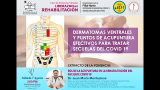 Dermatomas Ventrales y puntos de Acupuntura Efectivos [upl. by Etnoj]