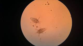 Zooplankton in the Microscope [upl. by Stuckey]