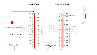 ESR Test  Erythrocyte Sedimentation Rate  ESR Determination  Erythrocyte Sedimentation Test [upl. by Llenyl]