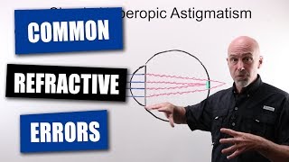 Common Refractive Errors Of The Human Eye [upl. by Khai]