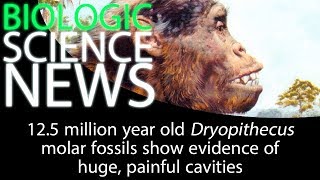 Science News  125 million year old Dryopithecus molar fossils show evidence of painful cavities [upl. by Aleece]