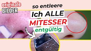 🚫👃 Mit dieser Methode Mitesser KOMPLETT entfernen  Einfacher gehts nicht  Mitesser loswerden [upl. by Innek]