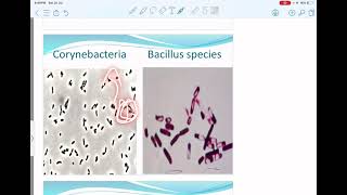 13gram positive bacilli [upl. by Perpetua925]