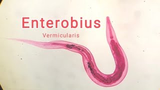 Enterobius vermicularis OXIURO [upl. by Nur]