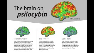 Psilocybin desynchronizes the human brain [upl. by Odlamur187]