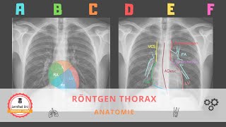 Anatomie im Röntgen Thorax [upl. by Goulden]