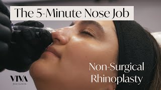 The 5Minute Nose Job 🟡 The NonSurgical Rhinoplasty by VIVA Skin Clinics [upl. by Cora]